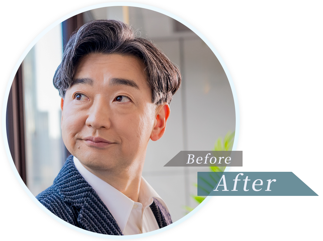 ビフォー画像